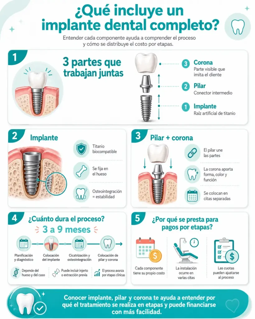 Que incluye un implante dental completo​