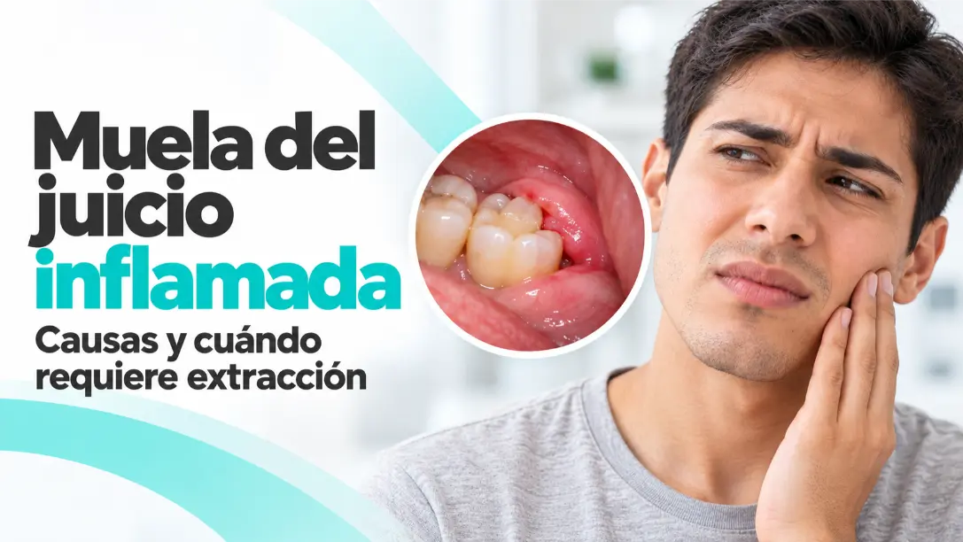 Muela del juicio