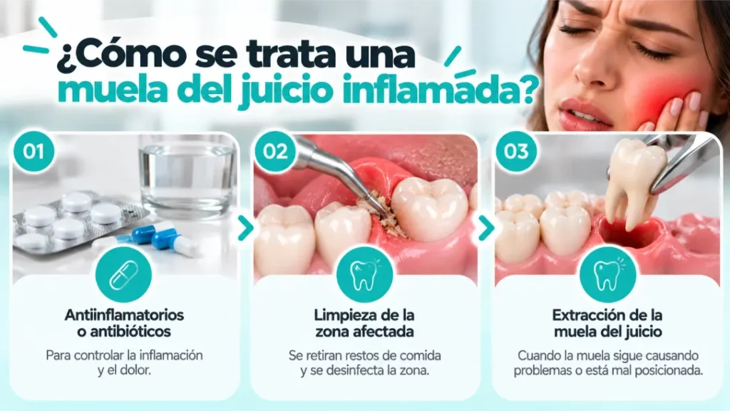 Como se trata una muela del juicio inflamada